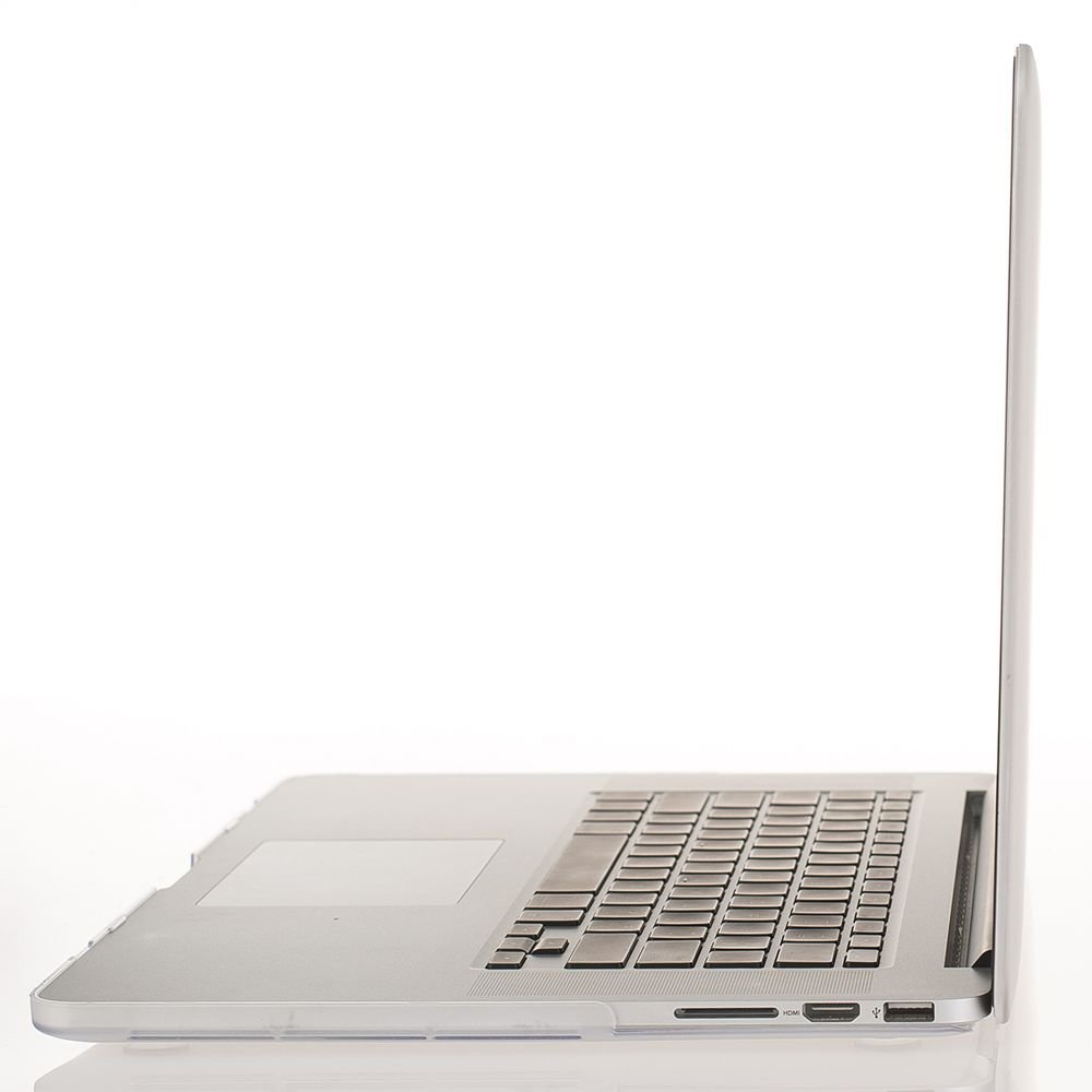 macbook-pro-13-cases5645b4639ce64